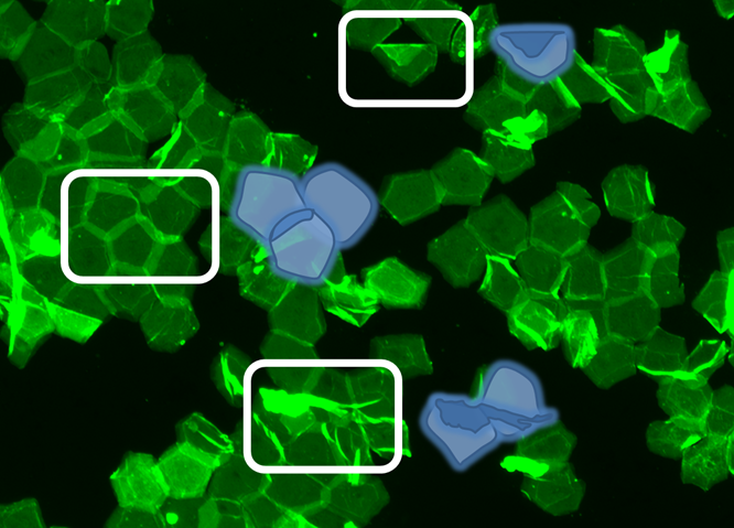 蛍光染色画像計測1