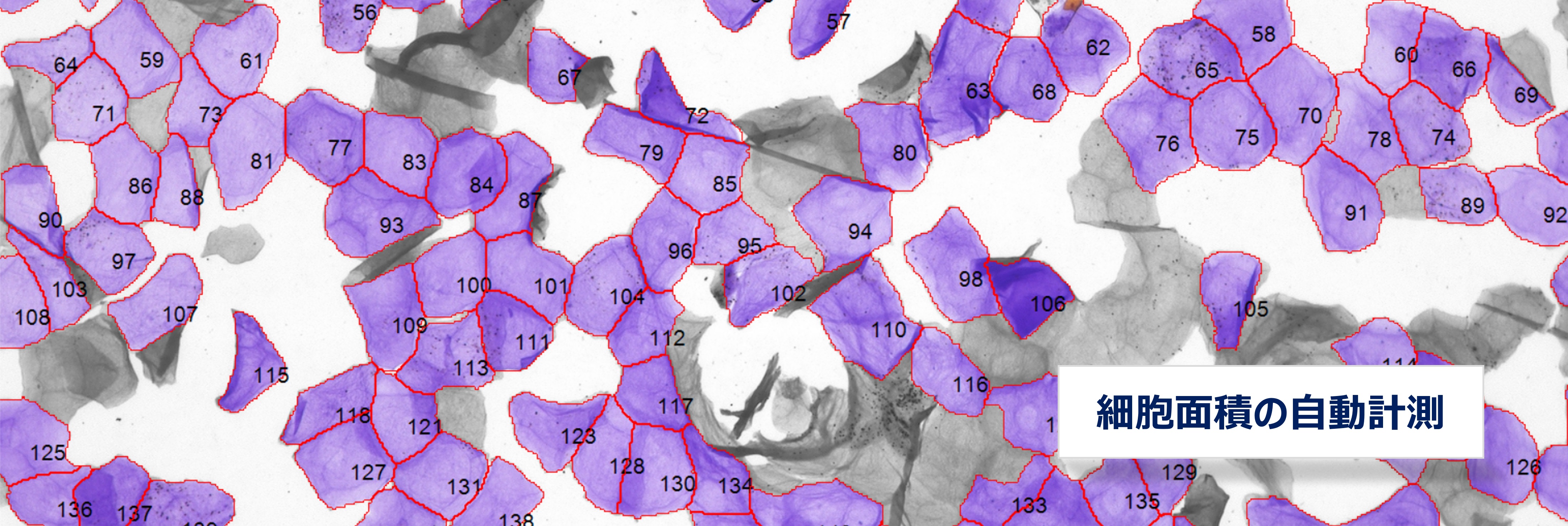 細胞面積の自動計測
