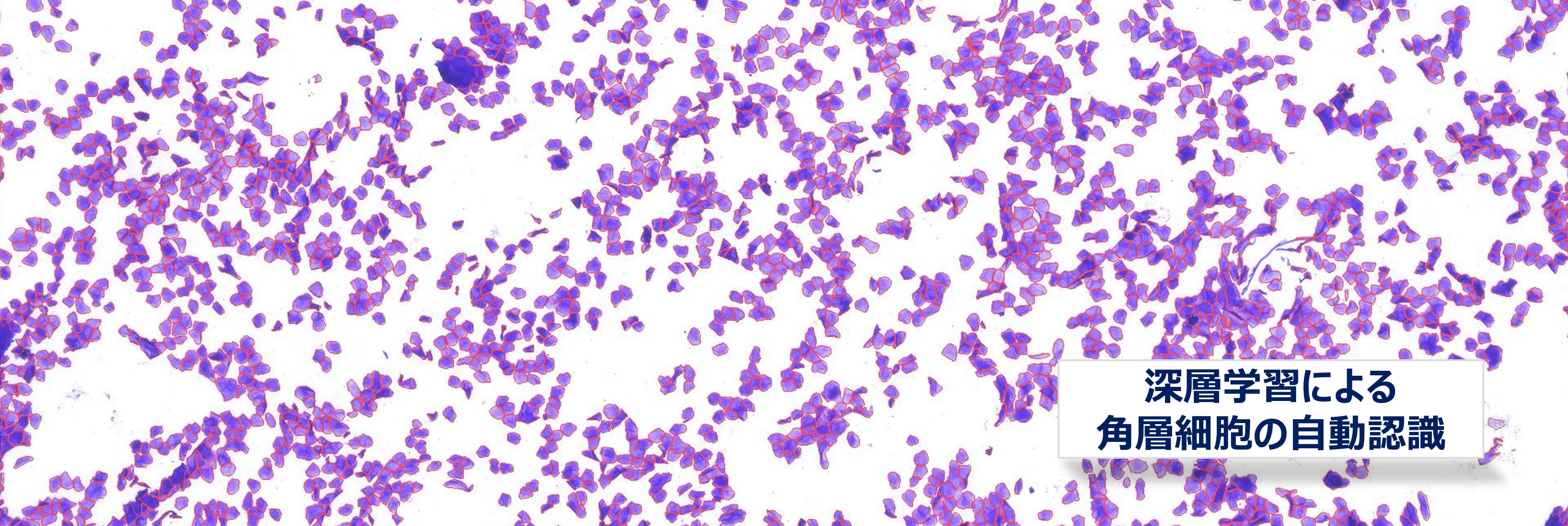 深層学習による角層細胞の自動認識